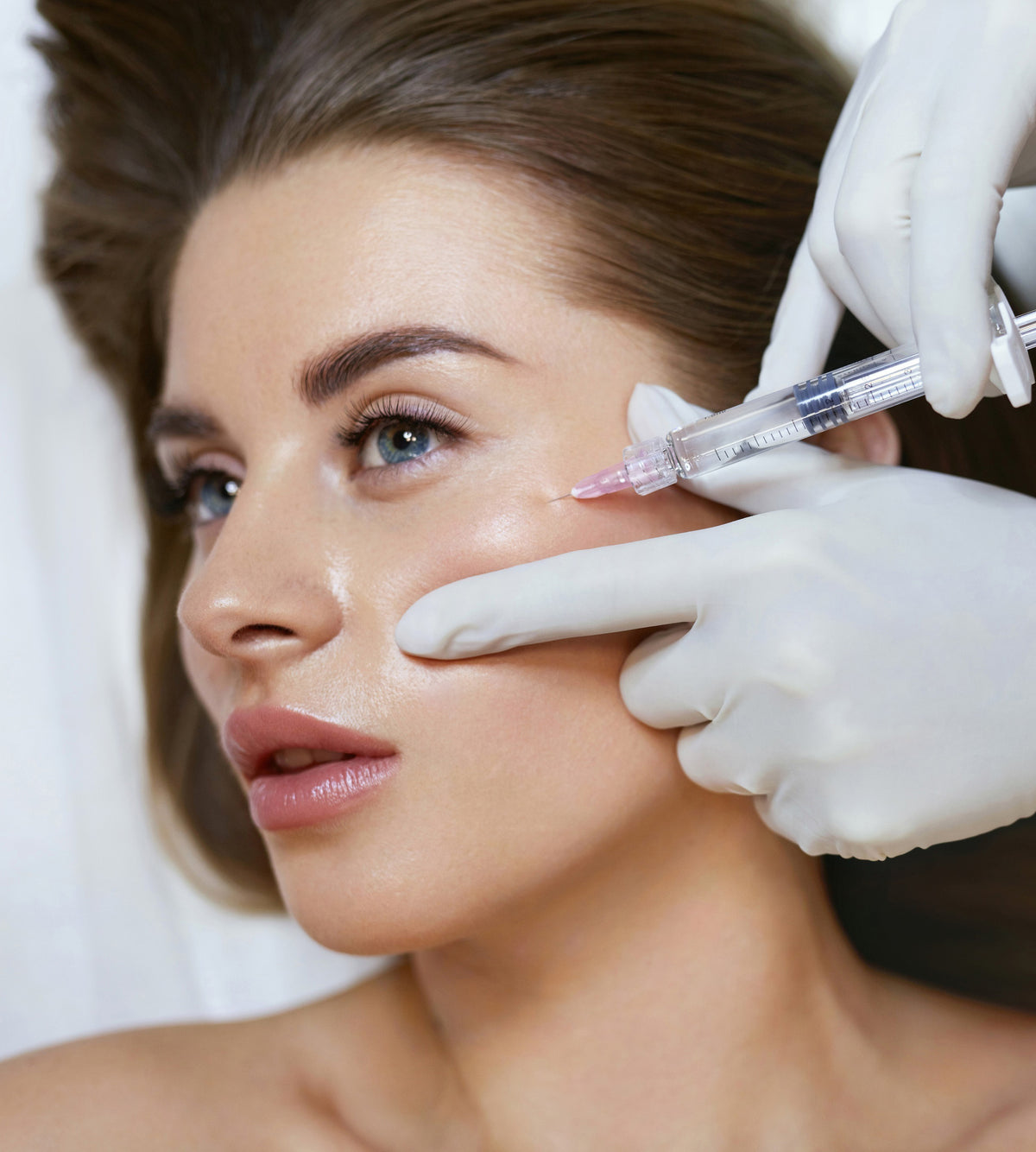 Facial Fillers